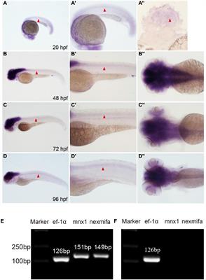 Nexmifa Regulates Axon Morphogenesis in Motor Neurons in Zebrafish